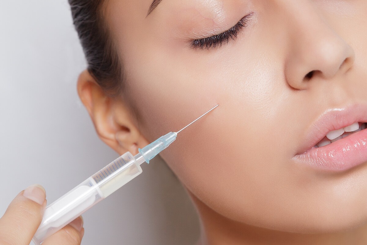 botox before after understanding the basics 2